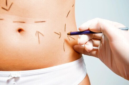 médicos despreparados na cirurgia plástica