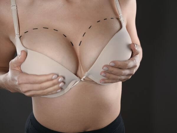mamoplastia de aumento